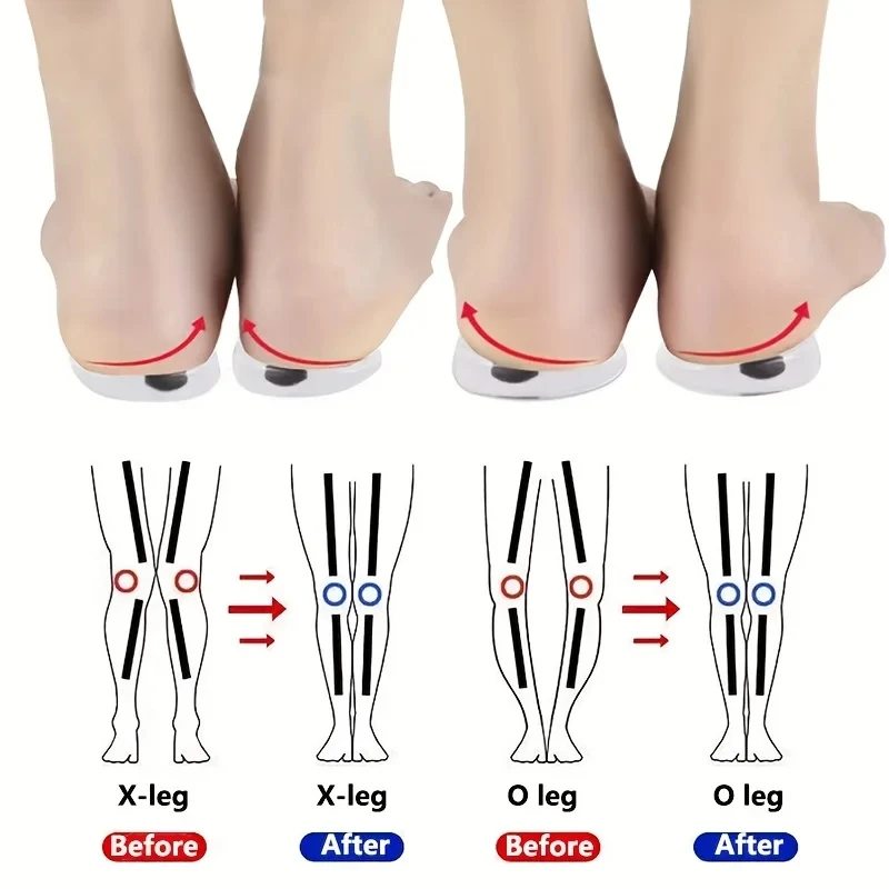 1 par de palmilhas ortopédicas - Women Shoes Types avaliação e preço
